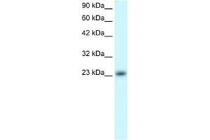 WB Suggested Anti-MXD4 Antibody Titration:  0. (MXD4 抗体  (N-Term))