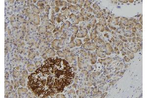 Immunohistochemistry (IHC) image for anti-Interleukin 1 Receptor, Type II (IL1R2) (C-Term) antibody (ABIN6262549)