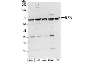 anti-Eukaryotic Translation Initiation Factor 3, Subunit L (EIF3L) (AA 514-564) antibody