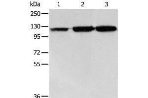 Western Blot analysis of PC3 cell, Human colon cancer and liver cancer tissue using HSP105 Polyclonal Antibody at dilution of 1:500 (HSPH1 抗体)