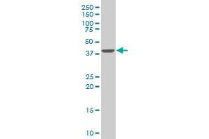 Western Blotting (WB) image for anti-SWI/SNF Related, Matrix Associated, Actin Dependent Regulator of Chromatin, Subfamily B, Member 1 (SMARCB1) (AA 81-180) antibody (ABIN520286)