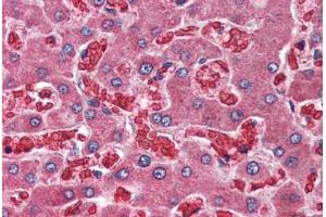 Human Liver (formalin-fixed, paraffin-embedded) stained with A2M antibody ABIN396916 at 10 ug/ml followed by biotinylated goat anti-rabbit IgG secondary antibody ABIN481713, alkaline phosphatase-streptavidin and chromogen. (alpha 2 Macroglobulin 抗体  (C-Term))