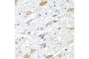 Immunohistochemistry of paraffin-embedded rat brain using CP antibody (ABIN6129673, ABIN6138930, ABIN6138932 and ABIN6217722) at dilution of 1:100 (40x lens).