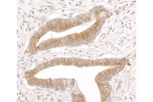 Immunohistochemistry (IHC) image for anti-Reticulocalbin 1, EF-Hand Calcium Binding Domain (RCN1) (AA 1-75) antibody (ABIN7453447)