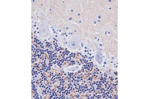 ABIN653897 staining H in human cerebellum tissue sections by Immunohistochemistry (IHC-P - paraformaldehyde-fixed, paraffin-embedded sections).