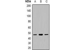Western blot analysis of CACNG5 expression in HepG2 (A), mouse liver (B), RAW264. (CACNG5 抗体)