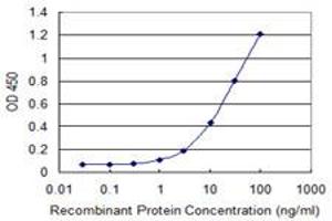 Detection limit for recombinant GST tagged USP45 is 0. (USP45 抗体  (AA 106-196))