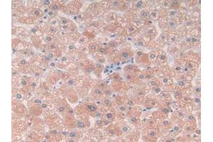 IHC-P analysis of Human Liver Tissue, with DAB staining. (C9 抗体  (AA 22-265))
