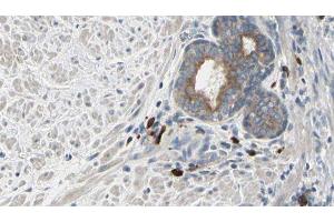 ABIN6277164 at 1/100 staining Human prostate tissue by IHC-P. (Phospholipase C gamma 2 抗体  (Internal Region))