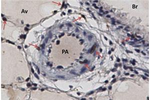 Immunohistochemistry (Paraffin-embedded Sections) (IHC (p)) image for anti-Replication Factor C (Activator 1) 2, 40kDa (RFC2) (AA 17-46), (N-Term) antibody (ABIN389297)
