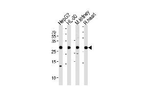 Western Blotting (WB) image for anti-ATP Synthase, H+ Transporting, Mitochondrial Fo Complex, Subunit B1 (ATP5F1) (AA 161-195) antibody (ABIN1881090)