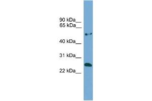 WB Suggested Anti-ETHE1  Antibody Titration: 0. (ETHE1 抗体  (Middle Region))