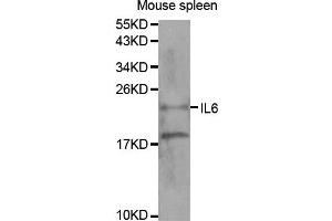 Western blot analysis of extracts of mouse spleen tissue, using IL6 antibody. (IL-6 抗体)