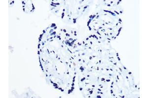 Immunohistochemistry of paraffin-embedded human placenta using DHX9/DHX9/RNA Helicase A Rabbit mAb (ABIN7265747) at dilution of 1:100 (40x lens). (DHX9 抗体)