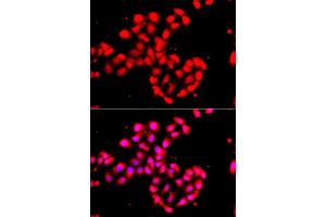 Immunofluorescence analysis of A549 cell using CAMK1D antibody. (CAMK1D 抗体)