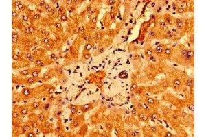 Immunohistochemistry of paraffin-embedded human liver tissue using ABIN7166602 at dilution of 1:100 (PSORS1C1 抗体  (AA 1-152))