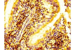 Immunohistochemistry (IHC) image for anti-ELK3, ETS-Domain Protein (SRF Accessory Protein 2) (ELK3) (AA 163-300) antibody (ABIN7152068)