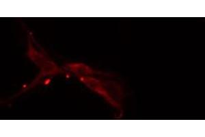 ABIN6274281 staining HepG2 cells by IF/ICC. (HNRNPF 抗体  (N-Term))