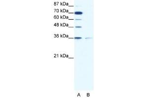 ZNF326 antibody (20R-1071) used at 0. (ZNF326 抗体  (C-Term))