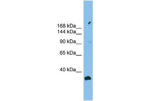 WB Suggested Anti-PACS2 Antibody Titration: 0. (PACS2 抗体  (Middle Region))