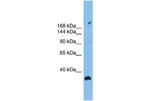 Western Blotting (WB) image for anti-phosphofurin Acidic Cluster Sorting Protein 2 (PACS2) (Middle Region) antibody (ABIN2784562)