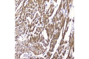 anti-Fatty Acid Binding Protein 3, Muscle and Heart (FABP3) (AA 2-133) antibody