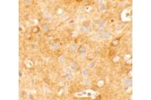 Immunohistochemistry of KCNK12 in mouse brain tissue with KCNK12 KCNK12 antibody at 5 ug/mL. (KCNK12 抗体  (C-Term))