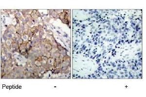 Image no. 1 for anti-Epidermal Growth Factor Receptor (EGFR) (Tyr1092) antibody (ABIN197231) (EGFR 抗体  (Tyr1092))