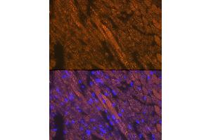Immunofluorescence analysis of mouse heart cells using Cardiac troponin T (TNNT2) Rabbit pAb (ABIN3021485, ABIN3021486, ABIN3021487 and ABIN6215132) at dilution of 1:100 (40x lens). (Cardiac Troponin T2 抗体  (AA 1-120))
