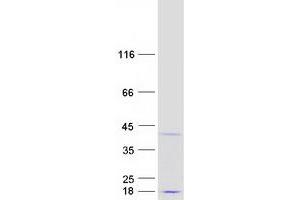 Validation with Western Blot