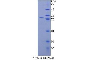 SDS-PAGE analysis of Rat NR0B1 Protein. (NR0B1 蛋白)
