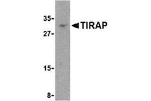 Western blot analysis of TIRAP in MCF-7 cell lysate with this product at 4 μg/ml. (TIRAP 抗体  (Center))