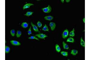 Immunofluorescent analysis of A549 cells using ABIN7170577 at dilution of 1:100 and Alexa Fluor 488-congugated AffiniPure Goat Anti-Rabbit IgG(H+L) (S1PR5 抗体  (AA 309-398))