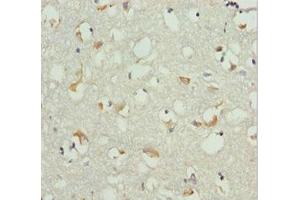 Immunohistochemistry of paraffin-embedded human brain tissue using ABIN7151540 at dilution of 1:100 (EEF1B2 抗体  (AA 1-225))