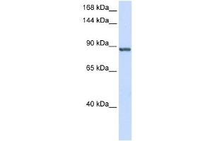 INTS6 antibody used at 1 ug/ml to detect target protein. (INTS6 抗体  (C-Term))