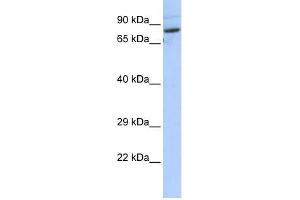SPTLC2 antibody used at 1 ug/ml to detect target protein. (SPTLC2 抗体  (N-Term))