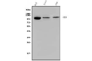 Western blot analysis of STAT6 using anti-STAT6 antibody (ABIN7600129).