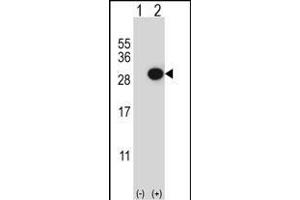Western blot analysis of CTHRC1 (arrow) using rabbit polyclonal CTHRC1 Antibody (N-term) (ABIN652724 and ABIN2842480). (CTHRC1 抗体  (N-Term))