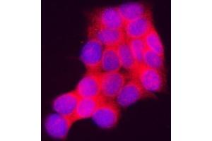 IF analysis of INPP4A using anti-INPP4A antibody (ABIN7601587).