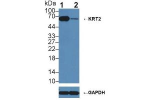 Western blot analysis of (1) Wild-type A431 cell lysate, and (2) KRT2 knockout A431 cell lysate, using Rabbit Anti-Rat KRT2 Antibody (1 µg/ml) and HRP-conjugated Goat Anti-Mouse antibody ( (Keratin 2 抗体  (AA 368-507))