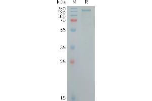 CD109 Protein (CD109) (AA 22-1420) (His tag)