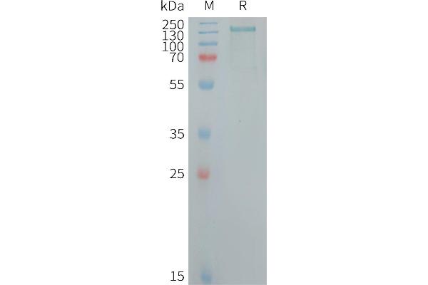 CD109 Protein (CD109) (AA 22-1420) (His tag)