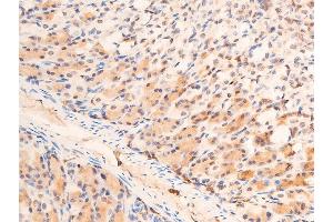 ABIN6267073 at 1/100 staining mouse gastric tissue sections by IHC-P. (CHEK1 抗体  (pSer280))