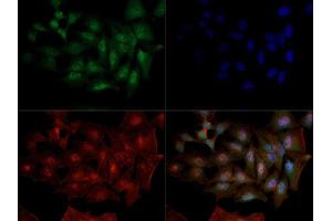 Immunofluorescent staining of HeLa cells with DNMT1 monoclonal antibody, clone 60B1220. (DNMT1 抗体  (AA 637-650))