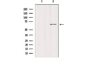 Western blot analysis of extracts from 293, using MED26 Antibody.