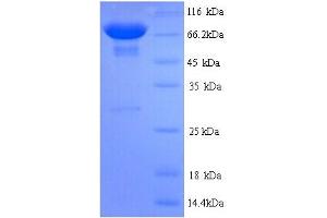 SDS-PAGE (SDS) image for Pyruvate Kinase, Liver and RBC (PKLR) (AA 1-574), (full length) protein (His tag) (ABIN5713734)