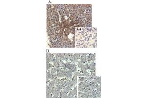 Immunohistochemical staining of human tissue using anti-ANGPTL4 (human), mAb (Kairos-1)  at 1:500 dilution. (ANGPTL4 抗体)