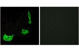 Immunofluorescence analysis of HeLa cells, using GPR17 Antibody. (GPR17 抗体  (AA 196-245))