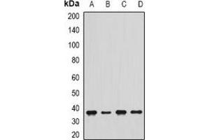 Western blot analysis of delta-Sarcoglycan expression in Jurkat (A), THP1 (B), mouse skeletal muscle (C), rat heart (D) whole cell lysates.