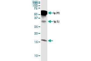 Immunoprecipitation of G0S2 transfected lysate using anti-G0S2 MaxPab rabbit polyclonal antibody and Protein A Magnetic Bead , and immunoblotted with G0S2 MaxPab rabbit polyclonal antibody (D01) . (G0S2 抗体  (AA 1-103))